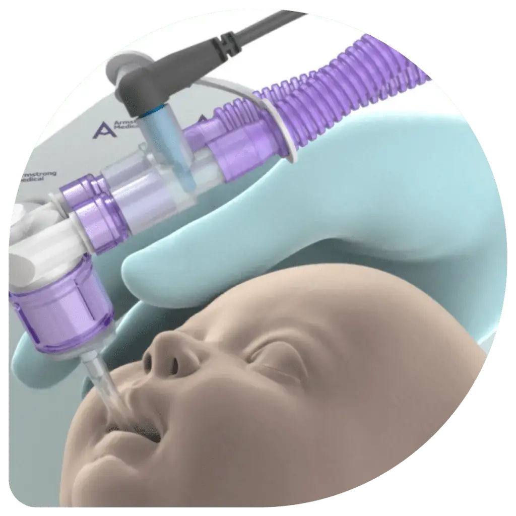 Computer generated image of a baby with Armstrong Medical Vapour Transmission device to show how gentle repositioning of infant results in minimal torque to the tracheal tube.