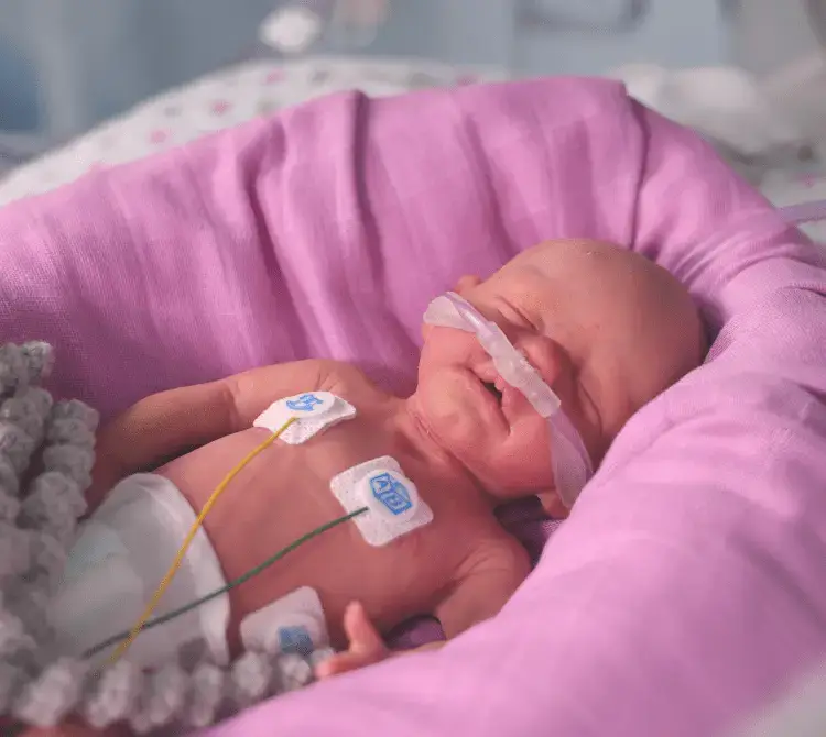 A neonate receiving HFOT via a nasal cannula A neonate receiving HFOT via a nasal cannula