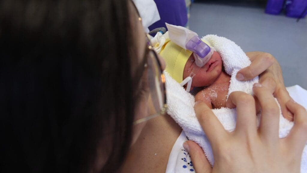 A woman holding a neonate wearing nasal prongs