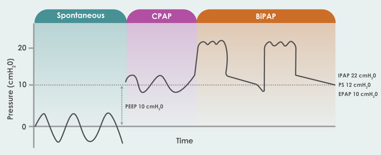 NonInvasiveVentilation Eakin Healthcare